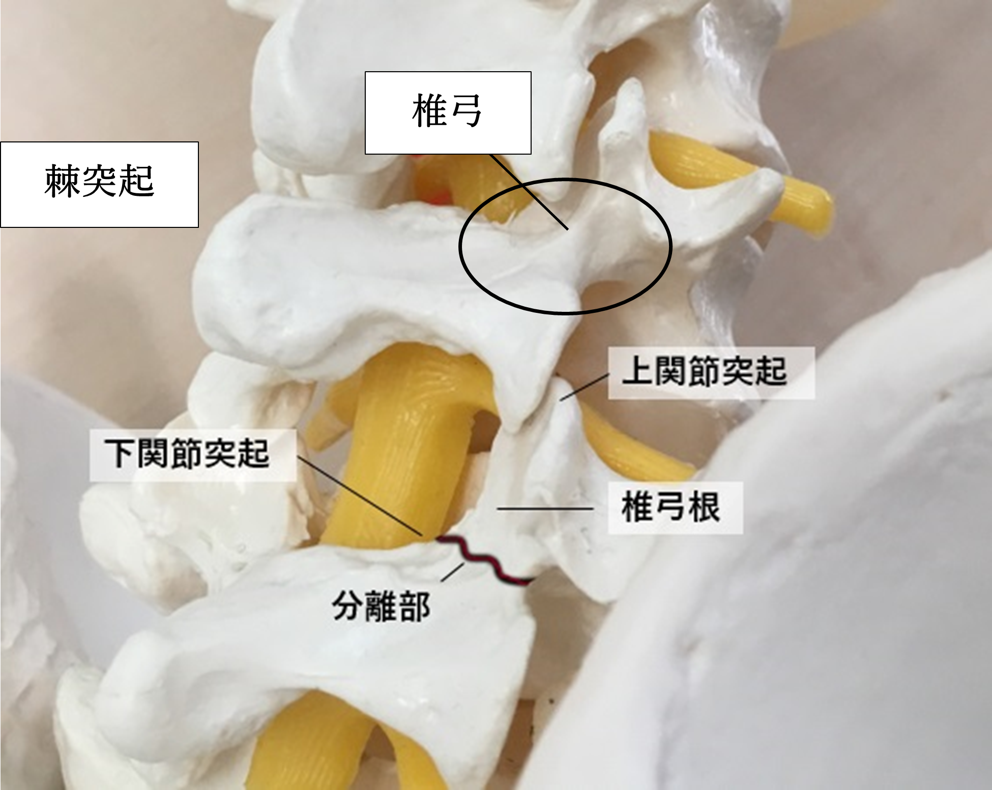 腰椎分離症は整骨院 Sports College にお任せ下さい 整骨院 Sports College